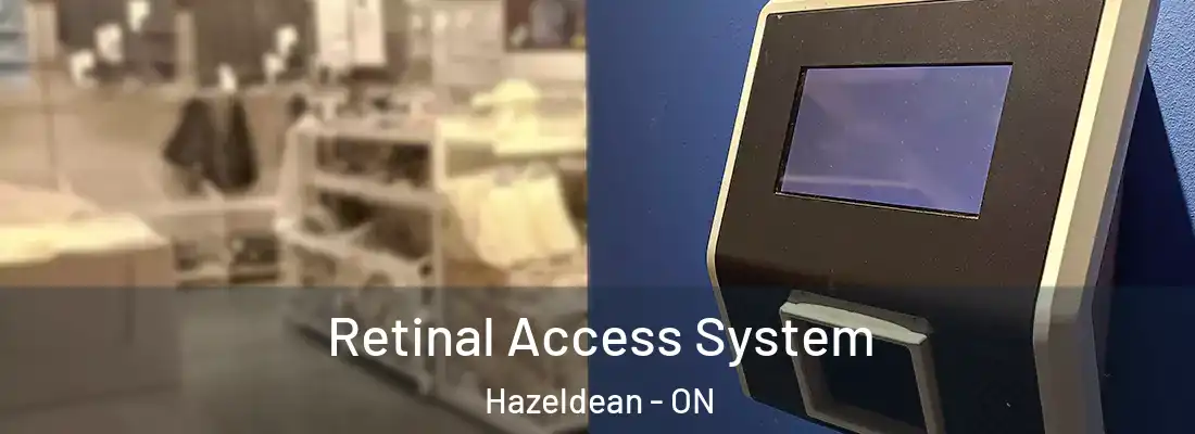  Retinal Access System Hazeldean - ON